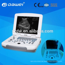 ecografos portatil &amp; ecografos de de china DW580